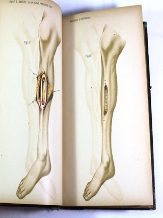Archivio di Ortopedia