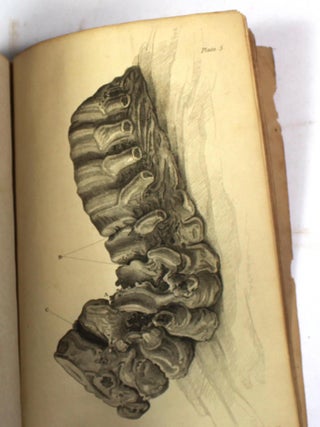 Pathological and Surgical Observations on the Diseases of the Joints