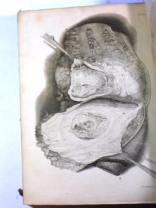 Pathological and Surgical Observations on the Diseases of the Joints