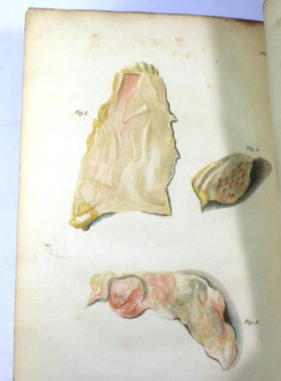 Pathological and Surgical Observations on the Diseases of the Joints