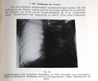 Sonderbände zur Strahlentherapie, 12-14