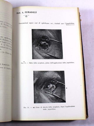 Annali di ottalmologia Anno XXXVIII